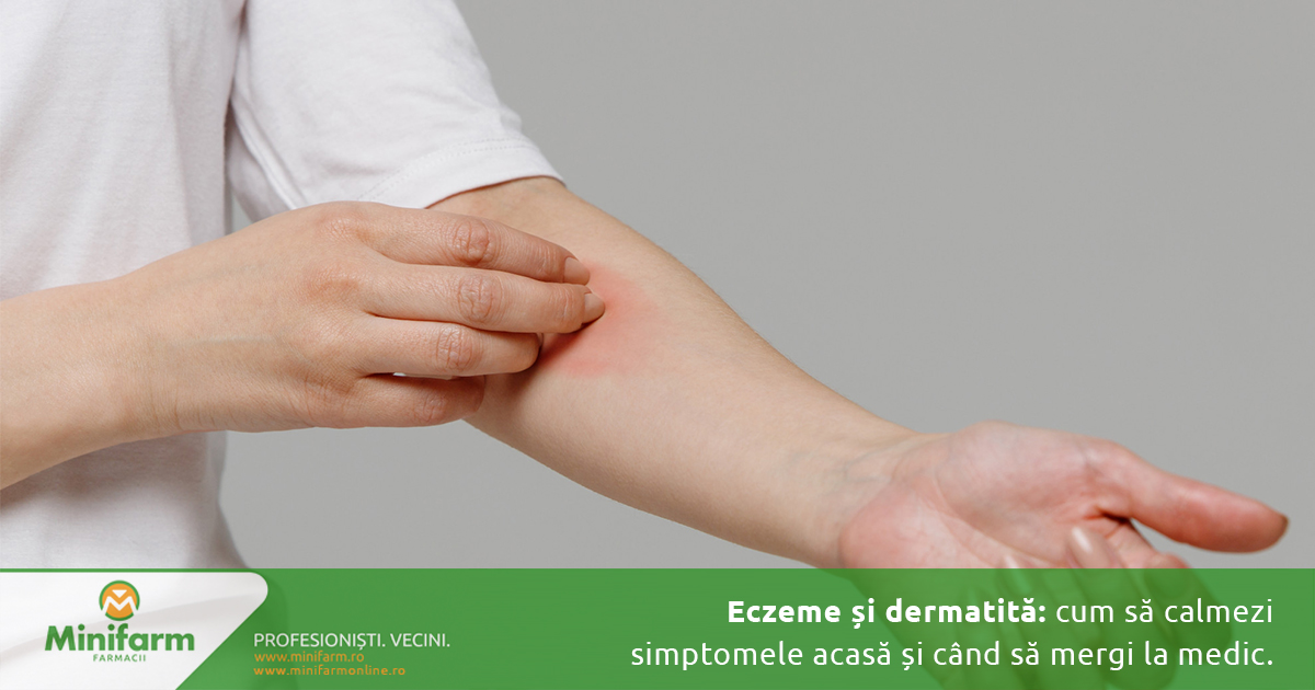 Eczeme și dermatită: cum să calmezi simptomele acasă și când să mergi la medic