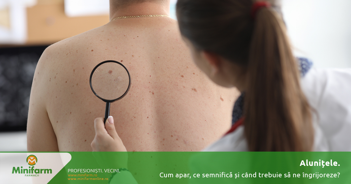 Alunițele: cum apar, ce semnifică și când trebuie să ne îngrijoreze