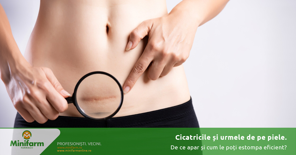 Cicatricile și urmele de pe piele: de ce apar și cum le poți estompa eficient