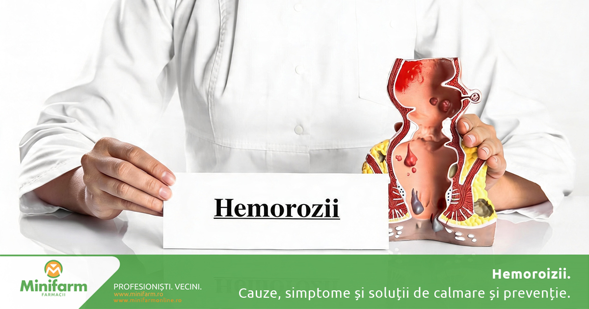 Hemoroizii: cauze, simptome și soluții eficiente pentru calmarea disconfortului și prevenirea complicațiilor