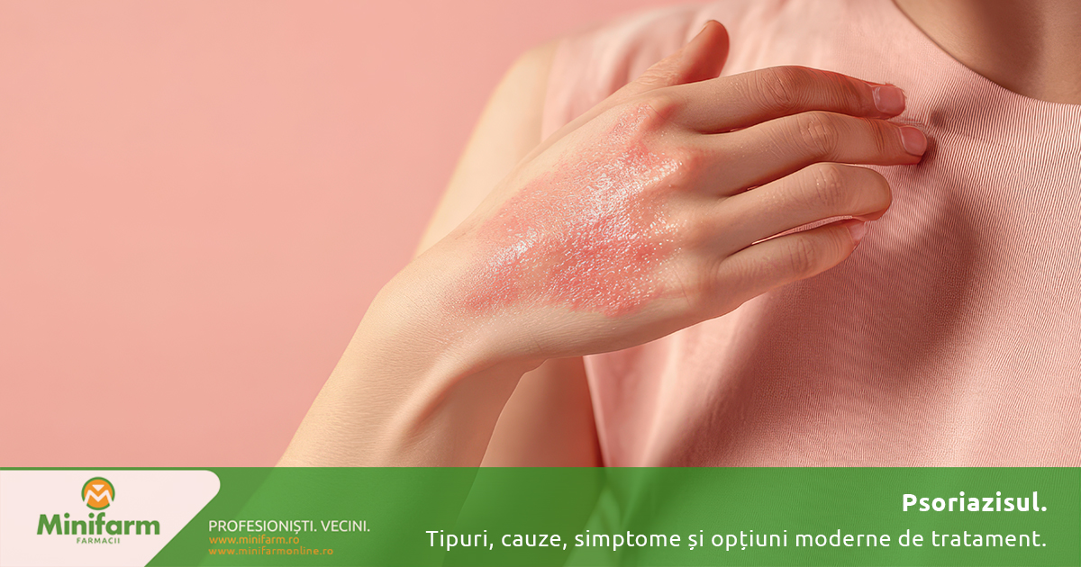 Psoriazisul: tipuri, cauze, simptome și opțiuni moderne de tratament