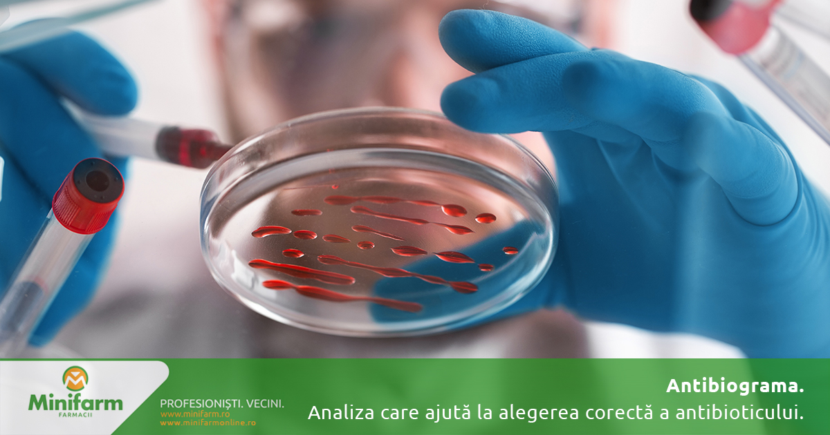 Antibiograma: analiza care ajută la alegerea corectă a antibioticului