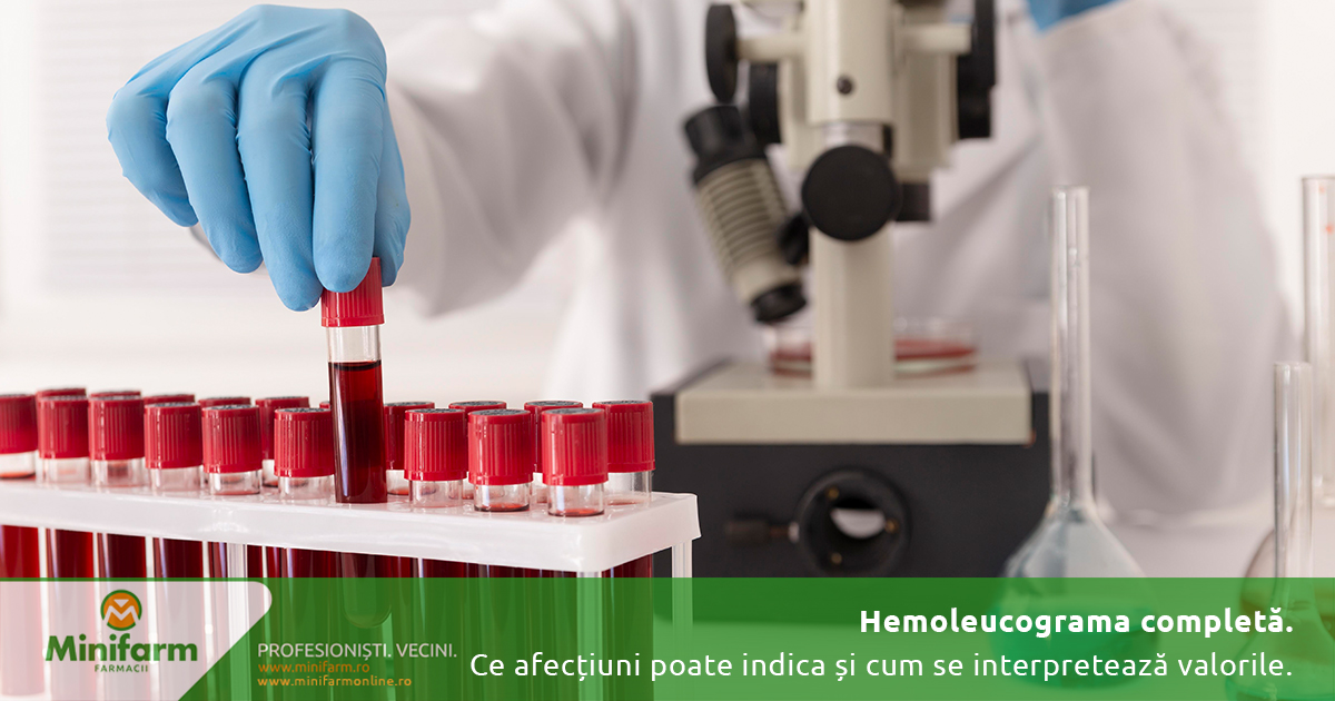 Hemoleucograma completă: ce afecțiuni poate indica și cum se interpretează valorile analizelor de sânge